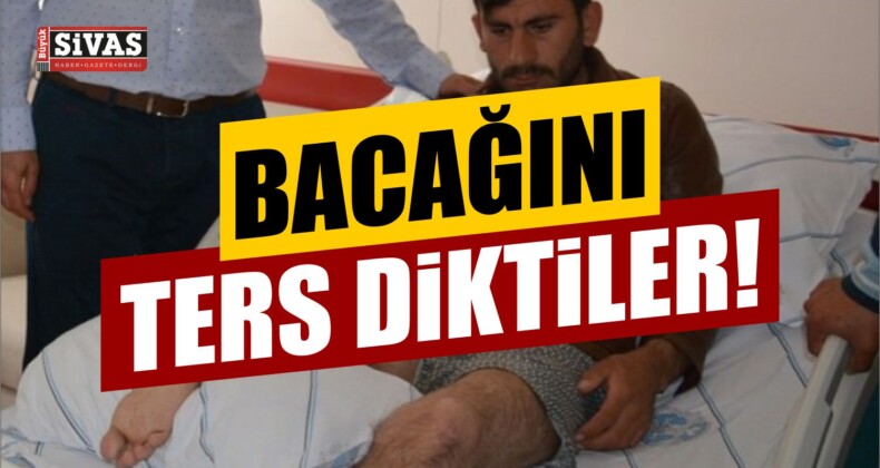 Ters Dikilen Bacak !