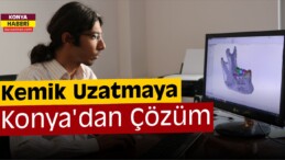 Konya’da Kemik Uzatmaya Yerli Çözüm