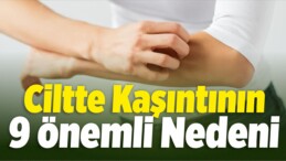 Ciltte Kaşıntının 9 Önemli Nedeni