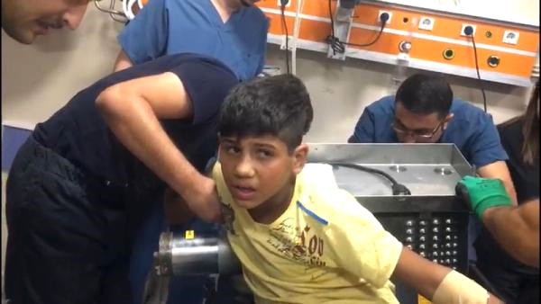 Suriyeli Ahmet in Kopan Parmakları Yerine Dikildi