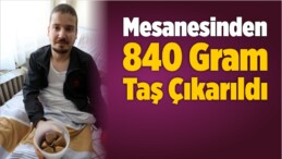 Mesanesinden 840 Gram Taş Çıkarıldı