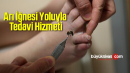 Arı İğnesi Yoluyla Çeşitli Hastalıklara Tedavi Hizmeti Başlatıldı