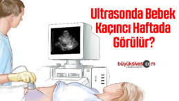 Ultrasonda bebek kaçıncı haftada görülür?