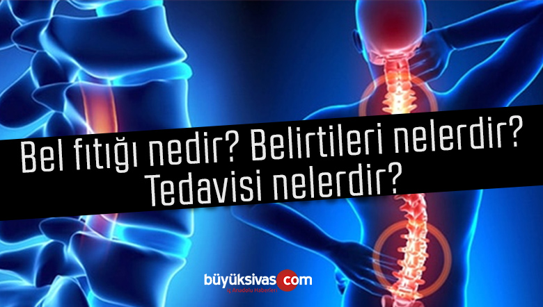 Download Bel fıtığı nedir? Belirtileri nelerdir? Tedavisi nelerdir?Büyük Sivas Haber | Sivas Haberleri ...