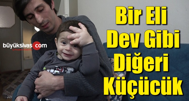 Bir eli dev gibi, diğeri küçücük