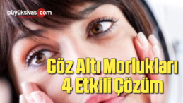 Göz Altı Morlukları 4 Etkili Çözüm 