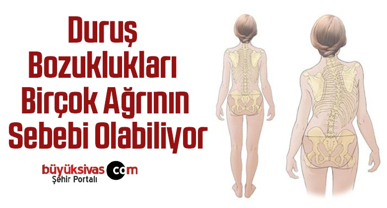 Duruş Bozuklukları Birçok Ağrının Sebebi Olabiliyor