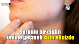 Sorunlu bir cildin önüne geçmek sizin elinizde