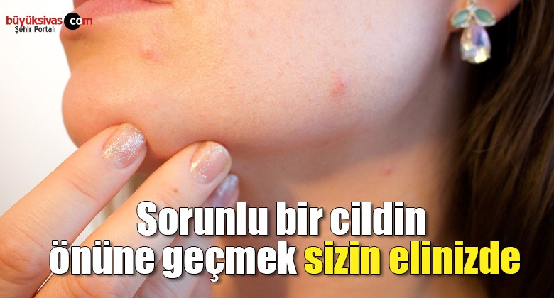 Sorunlu bir cildin önüne geçmek sizin elinizde