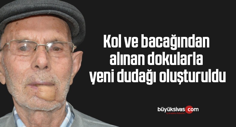 Kol ve bacağından alınan dokularla yeni dudağı oluşturuldu