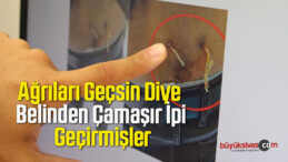 Ağrıları Geçsin Diye Belinden Çamaşır İpi Geçirmişler