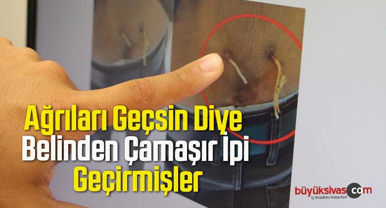 Ağrıları Geçsin Diye Belinden Çamaşır İpi Geçirmişler