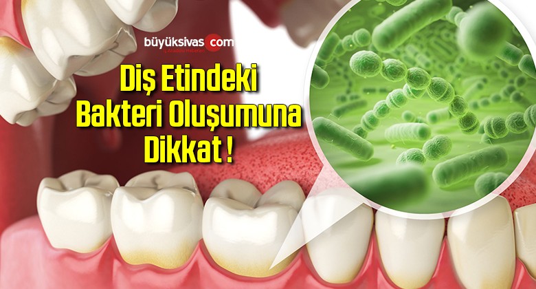 Diş Etindeki Bakteri Oluşumuna Dikkat !