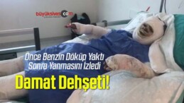 Üzerine Benzin Döküp Ateşe Verdiği Kayınvalidesinin Alevler İçinde Yanmasını İzledi