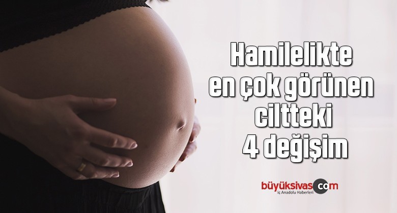 Hamilelikte en çok görünen ciltteki 4 değişim