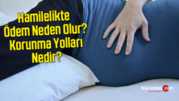 Hamilelikte Ödem Neden Olur? Korunma Yolları Nedir?