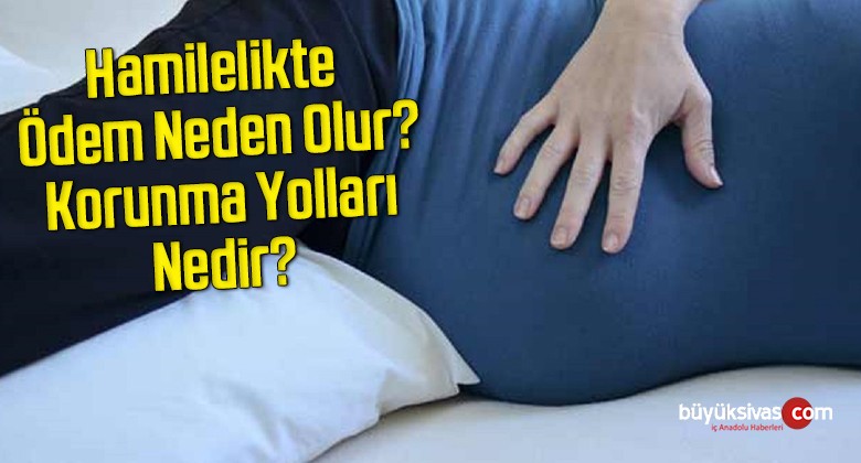 Hamilelikte Ödem Neden Olur? Korunma Yolları Nedir?