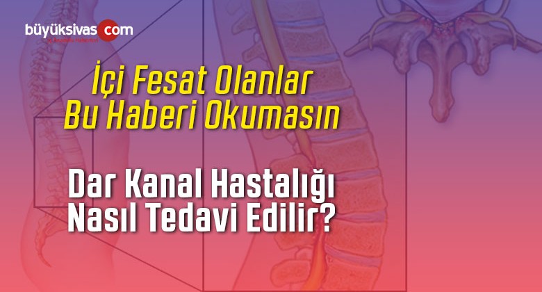 Dar Kanal Hastalığı nedir? Dar Kanal Hastalığı Olanlar Dikkat!