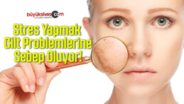 Stres Yapmak Cilt Problemlerine Sebep Oluyor!