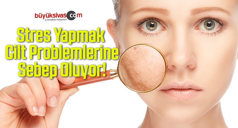 Stres Yapmak Cilt Problemlerine Sebep Oluyor!