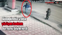 Güpegündüz yolda yürüyen kadının burnunu böyle kırdı