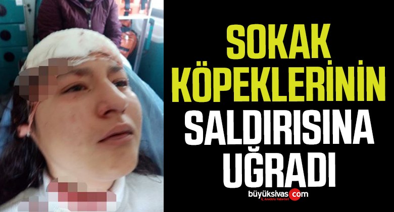 Fotoğraf çeken genç kız 5 köpeğin saldırısına uğradı