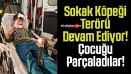 Köpeklerin Saldırısına Uğrayan Çocuk Ağır Yaralandı