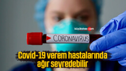 Covid-19 verem hastalarında ağır seyredebilir