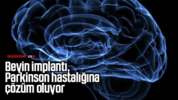 Beyin implantı, Parkinson hastalığına çözüm oluyor