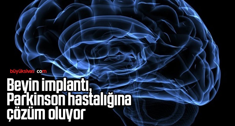 Beyin implantı, Parkinson hastalığına çözüm oluyor