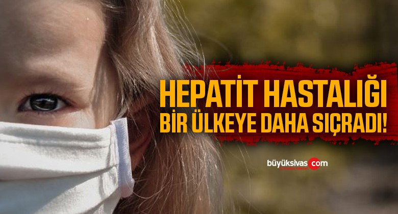 Hepatit hastalığı bir ülkeye daha sıçradı