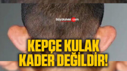 Kepçe Kulak Kader Değildir!