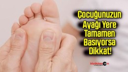 Çocuğunuzun Ayağı Yere Tamamen Basıyorsa Dikkat!