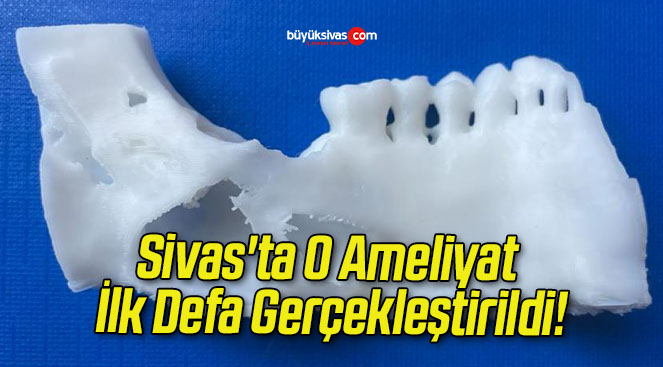 Sivas’ta O Ameliyat İlk Defa Gerçekleştirildi!