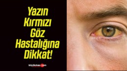 Yazın Kırmızı Göz Hastalığına Dikkat!