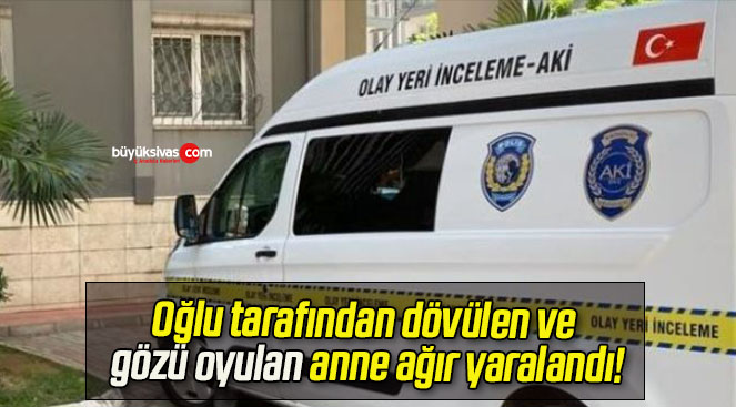 Oğlu tarafından dövülen ve gözü oyulan anne ağır yaralandı!