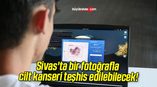 Sivas’ta bir fotoğrafla cilt kanseri teşhis edilebilecek!