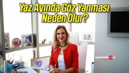 Yaz Ayında Göz Yanması Neden Olur?