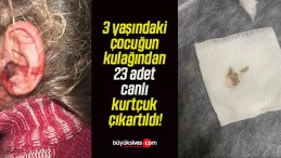 3 yaşındaki çocuğun kulağından 23 adet canlı kurtçuk çıkartıldı!