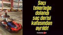 Saçı tekerleğe dolandı saç derisi kafasından ayrıldı!