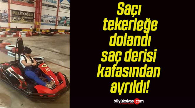 Saçı tekerleğe dolandı saç derisi kafasından ayrıldı!