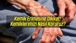 Kemik Erimesine Dikkat! Kemiklerimizi Nasıl Koruruz?