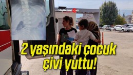 2 yaşındaki çocuk çivi yuttu!