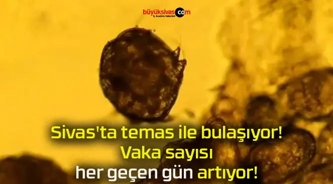 Sivas’ta temas ile bulaşıyor! Vaka sayısı her geçen gün artıyor!