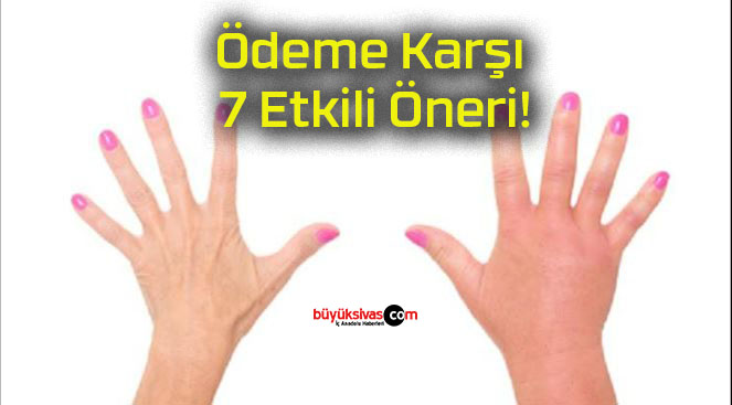 Ödeme Karşı 7 Etkili Öneri!