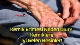 Kemik Erimesi Neden Olur? Kemiklere İyi Gelen Besinler!