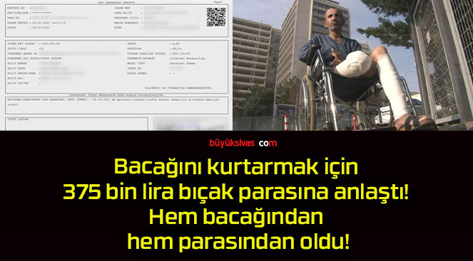 Bacağını kurtarmak için 375 bin lira bıçak parasına anlaştı! Hem bacağından hem parasından oldu!