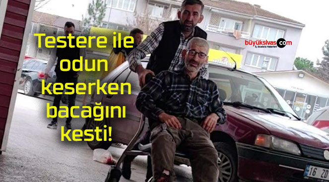 Testere ile odun keserken bacağını kesti!