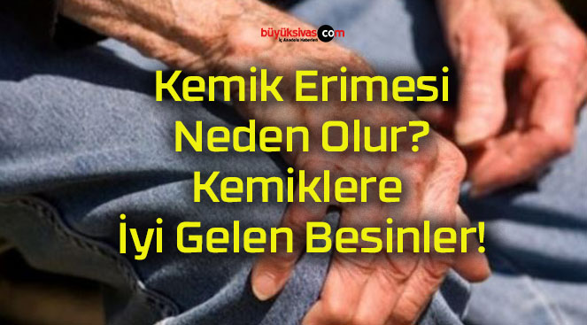 Kemik Erimesi Neden Olur? Kemiklere İyi Gelen Besinler!