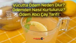 Vücutta Ödem Neden Olur? Ödemden Nasıl Kurtuluruz? Ödem Atıcı Çay Tarifi!